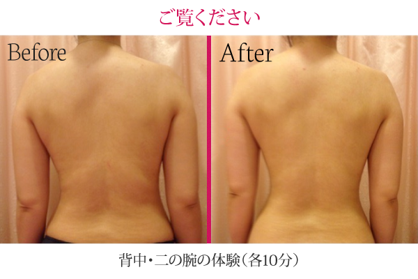 背中・二の腕の体験（10分） Before After